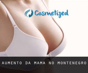 Aumento da mama no Montenegro Aumento da mama no Montenegro