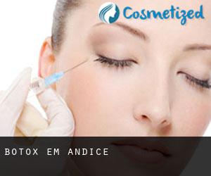 Botox em Andice