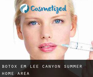 Botox em Lee Canyon Summer Home Area