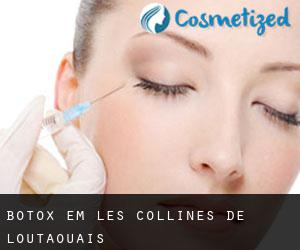 Botox em Les Collines-de-l'Outaouais