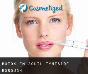 Botox em South Tyneside (Borough)
