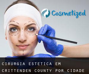 Cirurgia Estética em Crittenden County por cidade importante - página 1