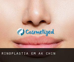 Rinoplastia em Ak Chin