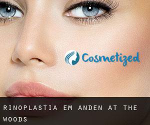 Rinoplastia em Anden at the Woods