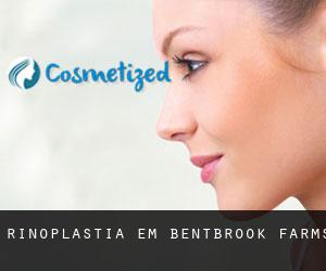 Rinoplastia em Bentbrook Farms