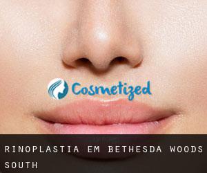 Rinoplastia em Bethesda Woods South