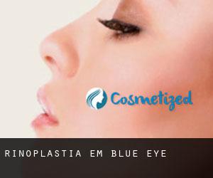 Rinoplastia em Blue Eye
