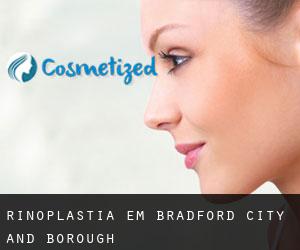 Rinoplastia em Bradford (City and Borough)