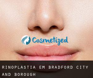 Rinoplastia em Bradford (City and Borough)