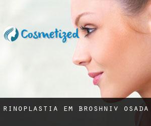 Rinoplastia em Broshniv-Osada