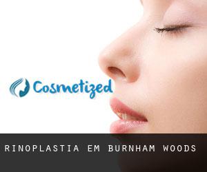 Rinoplastia em Burnham Woods