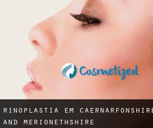 Rinoplastia em Caernarfonshire and Merionethshire