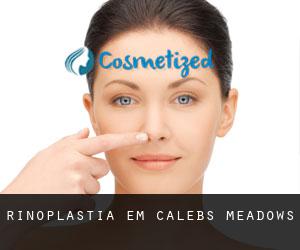 Rinoplastia em Calebs Meadows