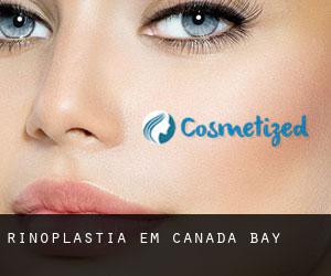 Rinoplastia em Canada Bay Rinoplastia em Canada Bay