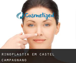 Rinoplastia em Castel Campagnano