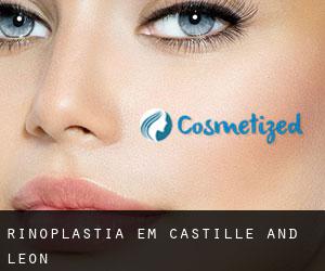 Rinoplastia em Castille and León Rinoplastia em Castille and León