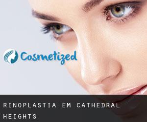 Rinoplastia em Cathedral Heights
