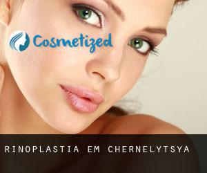 Rinoplastia em Chernelytsya