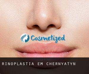 Rinoplastia em Chernyatyn