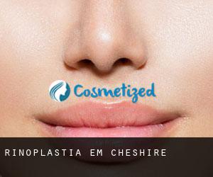 Rinoplastia em Cheshire