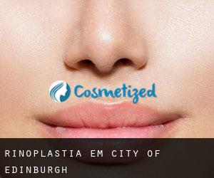 Rinoplastia em City of Edinburgh