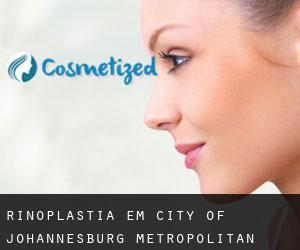 Rinoplastia em City of Johannesburg Metropolitan Municipality