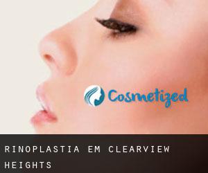 Rinoplastia em Clearview Heights
