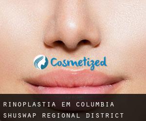 Rinoplastia em Columbia-Shuswap Regional District