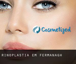 Rinoplastia em Fermanagh Rinoplastia em Fermanagh