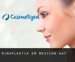 Rinoplastia em Mexican Hat