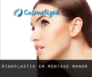 Rinoplastia em Montage Manor