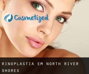 Rinoplastia em North River Shores