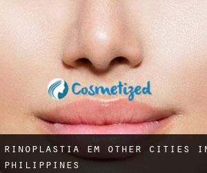 Rinoplastia em Other Cities in Philippines
