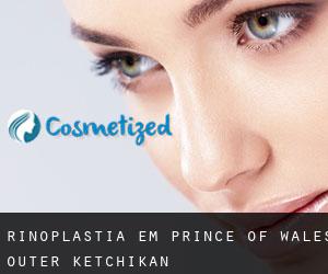 Rinoplastia em Prince of Wales-Outer Ketchikan