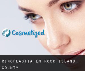 Rinoplastia em Rock Island County Rinoplastia em Rock Island County