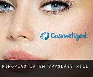 Rinoplastia em Spyglass Hill