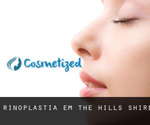 Rinoplastia em The Hills Shire Rinoplastia em The Hills Shire