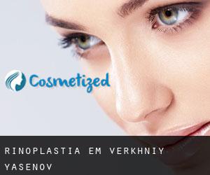 Rinoplastia em Verkhniy Yasenov