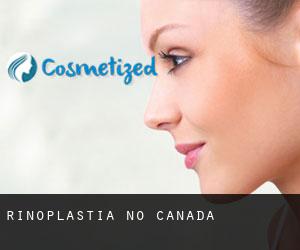 Rinoplastia no Canadá Rinoplastia no Canadá