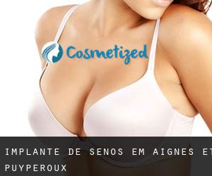 Implante de Senos em Aignes-et-Puypéroux
