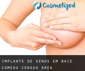 Implante de Senos em Baie-Comeau (census area)