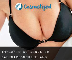 Implante de Senos em Caernarfonshire and Merionethshire por cidade - página 3