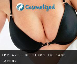 Implante de Senos em Camp Jayson