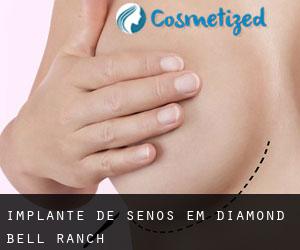 Implante de Senos em Diamond Bell Ranch