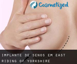 Implante de Senos em East Riding of Yorkshire