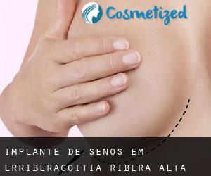 Implante de Senos em Erriberagoitia / Ribera Alta