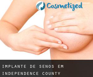 Implante de Senos em Independence County