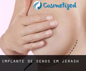 Implante de Senos em Jerash