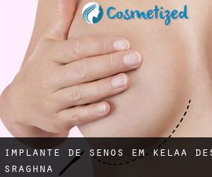 Implante de Senos em Kelaa-Des-Sraghna