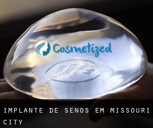 Implante de Senos em Missouri City